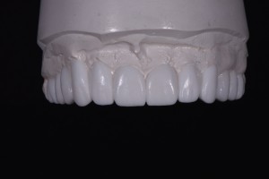 Mold of Teeth